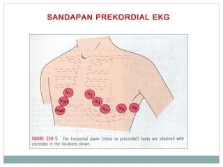SANDAPAN PREKORDIAL EKG
 