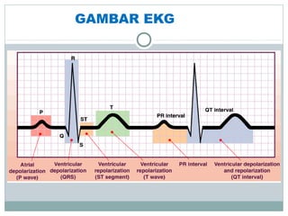 GAMBAR EKG
 