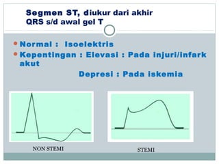 Segmen ST, diukur dari akhir
QRS s/d awal gel T
Normal : Isoelektris
Kepentingan : Elevasi : Pada injuri/infark
akut
Depresi : Pada iskemia
NON STEMI STEMI
 