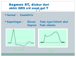 Segmen ST, diukur dari
akhir QRS s/d awal gel T
Normal : Isoelektris
Kepentingan : Elevasi Pada injuri/infark akut
Depresi Pada iskemia
Non STEMI
STEMI
 