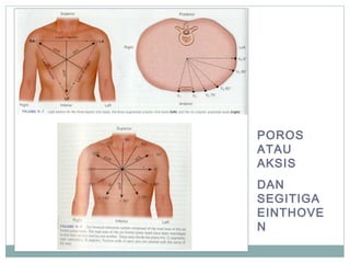 POROS
ATAU
AKSIS
DAN
SEGITIGA
EINTHOVE
N
 