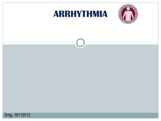 ARRHYTHMIA
Smg, 16112012
 