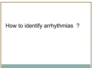 How to identify arrhythmias ?
 