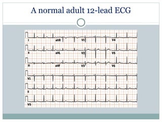 A normal adult 12-lead ECG
 