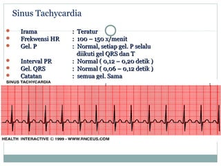  IramaIrama :: TeraturTeratur
 Frekwensi HRFrekwensi HR :: 100 – 150 x/menit100 – 150 x/menit
 Gel. PGel. P :: Normal, setiap gel.Normal, setiap gel. PP selaluselalu
diikuti gel QRS dan Tdiikuti gel QRS dan T
 Interval PRInterval PR :: Normal ( 0,12 – 0,20 detik )Normal ( 0,12 – 0,20 detik )
 Gel. QRSGel. QRS :: Normal ( 0,06 – 0,12 detik )Normal ( 0,06 – 0,12 detik )
 CatatanCatatan :: semua gel. Samasemua gel. Sama
Sinus Tachycardia
 