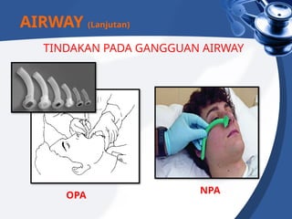 OPA NPA
TINDAKAN PADA GANGGUAN AIRWAY
AIRWAY (Lanjutan)
 