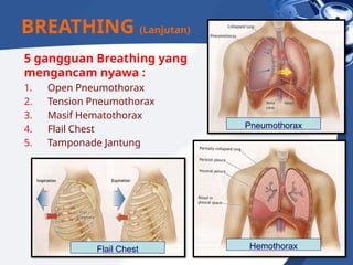 5 gangguan Breathing yang
mengancam nyawa :
1. Open Pneumothorax
2. Tension Pneumothorax
3. Masif Hematothorax
4. Flail Chest
5. Tamponade Jantung
BREATHING (Lanjutan)
Pneumothorax
Hemothorax
Flail Chest
 
