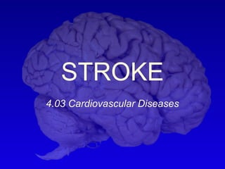 STROKE
4.03 Cardiovascular Diseases
 