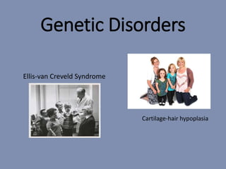 Genetic Disorders
Ellis-van Creveld Syndrome
Cartilage-hair hypoplasia
 