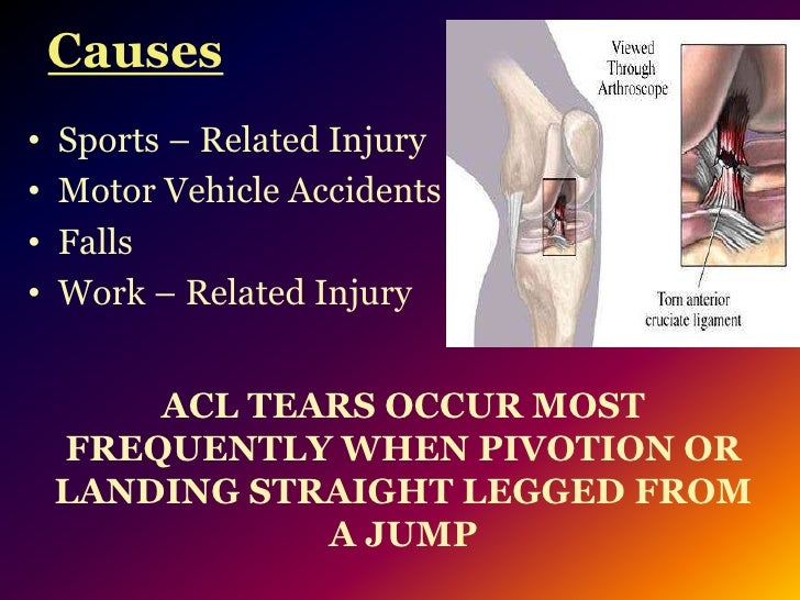 405 acl presentation