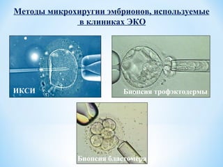 Методы микрохиругии эмбрионов, используемые в клиниках ЭКО ИКСИ Биопсия трофэктодермы Биопсия бластомера 