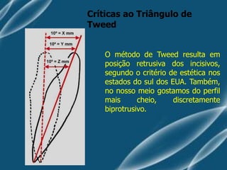 Análise cefalométrica de tweed ortodontia | PDF