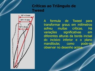 Análise cefalométrica de tweed ortodontia | PDF