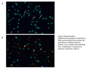 A
B	
  
30μm	
  
30μm	
  
Figure	
  1	
  Representa5ve	
  
epiﬂuorescence	
  graphs	
  of	
  cultured	
  rat	
  
DRG	
  neurons	
  before	
  (A)	
  and	
  aCer	
  (B)	
  
applica5on	
  of	
  100nM	
  capsaicin.	
  
Arrows,	
  Fura-­‐2-­‐loaded	
  cells	
  exhibi5ng	
  
Ca2+	
  	
  mobiliza5on	
  in	
  response	
  to	
  
capsaicin.	
  (Scale	
  bars,	
  30μm.)	
  
 