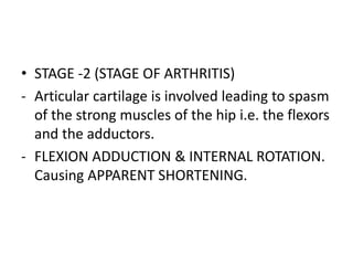 • STAGE -2 (STAGE OF ARTHRITIS)
- Articular cartilage is involved leading to spasm
of the strong muscles of the hip i.e. the flexors
and the adductors.
- FLEXION ADDUCTION & INTERNAL ROTATION.
Causing APPARENT SHORTENING.
 