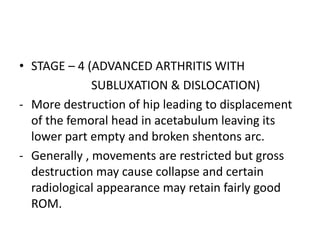• STAGE – 4 (ADVANCED ARTHRITIS WITH
SUBLUXATION & DISLOCATION)
- More destruction of hip leading to displacement
of the femoral head in acetabulum leaving its
lower part empty and broken shentons arc.
- Generally , movements are restricted but gross
destruction may cause collapse and certain
radiological appearance may retain fairly good
ROM.
 