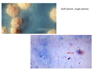 Buff colored , rough colonies
 