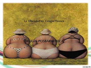 CIRUGÍA POSBARIATRICA
La Obesidad en Cirugía Plástica
Md. Leticia Tapia Parada
Posgrado CirugíaPlástica Reconstructiva yEstética
 