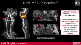 41.7.Costello_Neurovascular-MRA Radiograpics Tutorial | PPTX