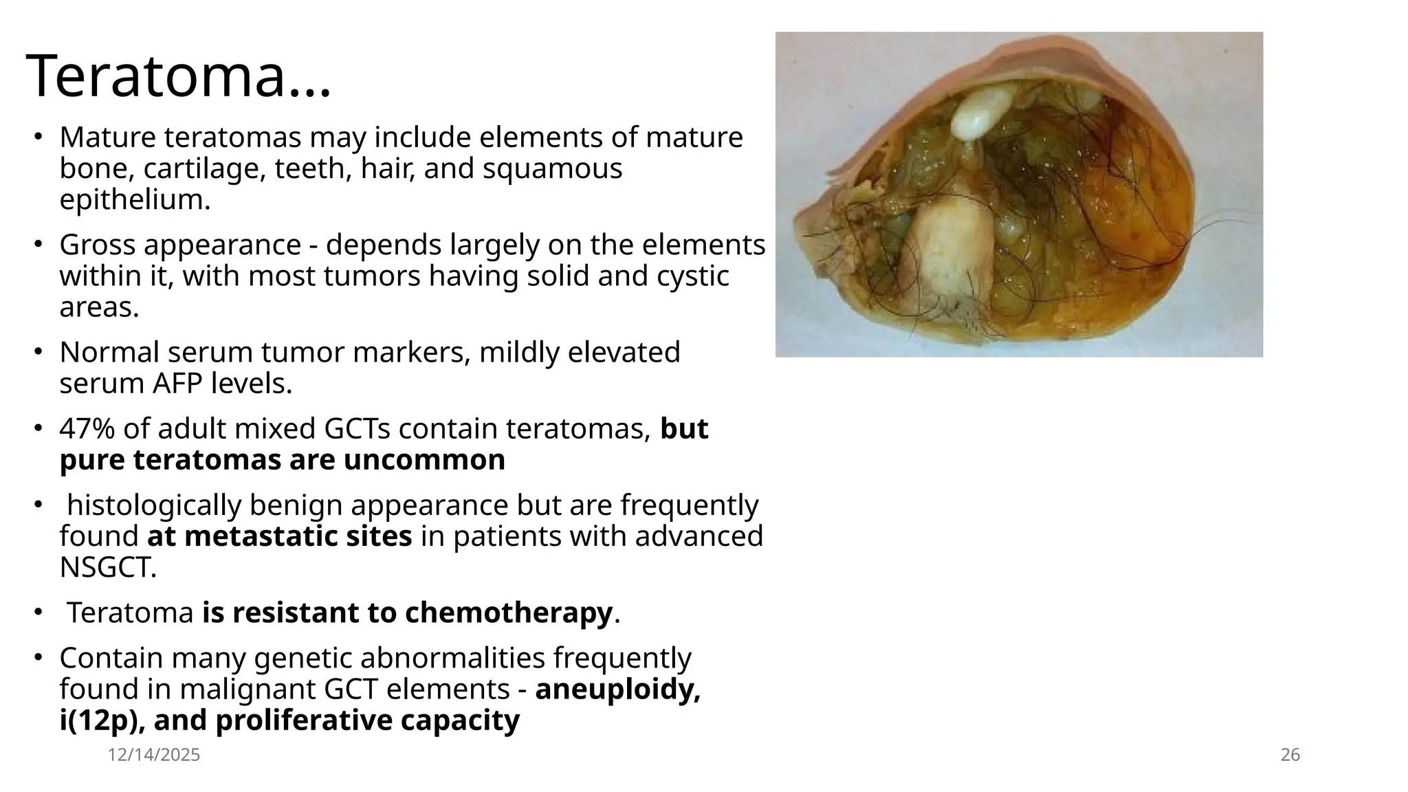 12/14/2025 26
• Mature teratomas may include elements of mature
bone, cartilage, teeth, hair, and squamous
epithelium.
• Gross appearance - depends largely on the elements
within it, with most tumors having solid and cystic
areas.
• Normal serum tumor markers, mildly elevated
serum AFP levels.
• 47% of adult mixed GCTs contain teratomas, but
pure teratomas are uncommon
• histologically benign appearance but are frequently
found at metastatic sites in patients with advanced
NSGCT.
• Teratoma is resistant to chemotherapy.
• Contain many genetic abnormalities frequently
found in malignant GCT elements - aneuploidy,
i(12p), and proliferative capacity
Teratoma…
 
