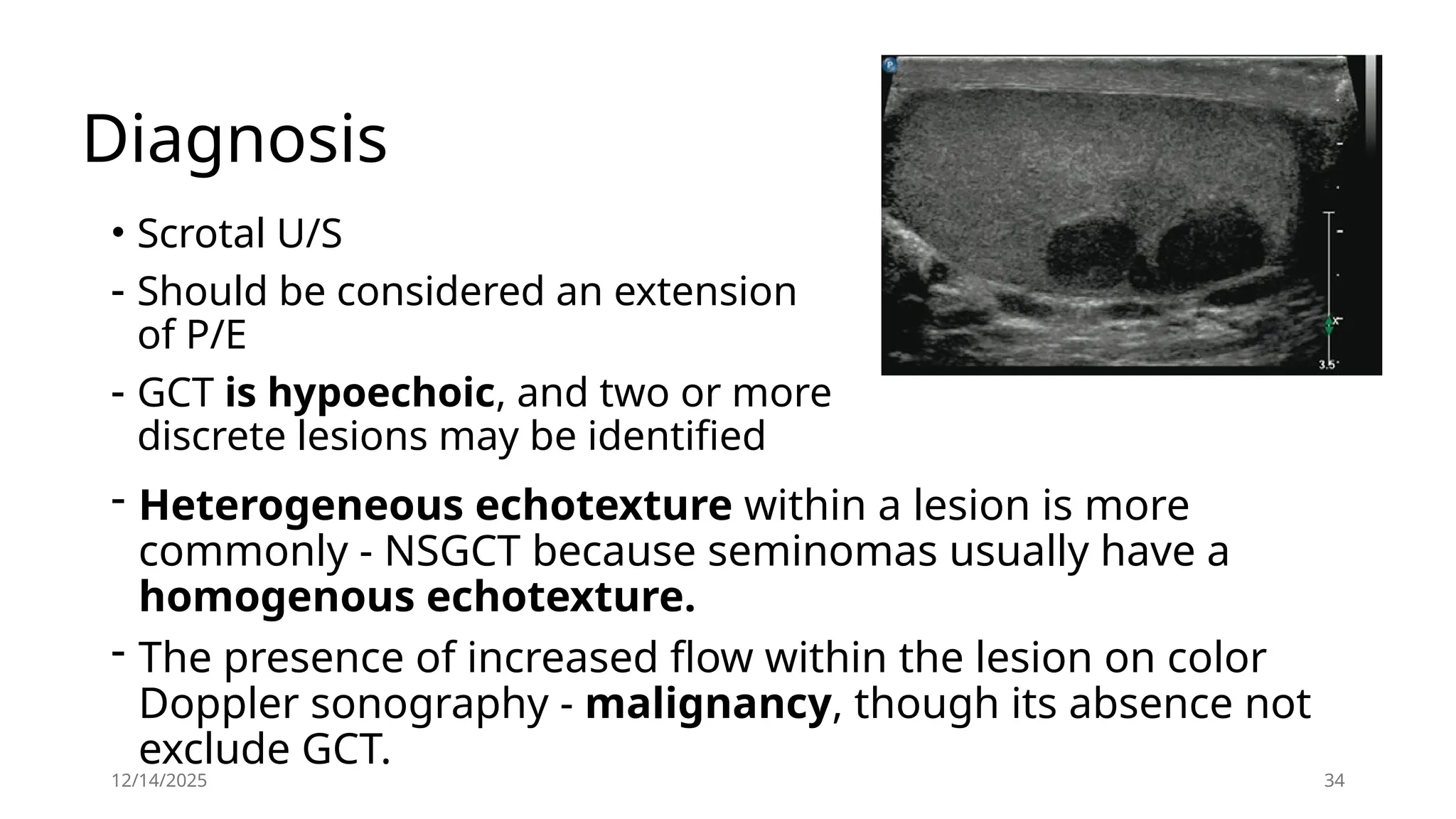 12/14/2025 34
Diagnosis
• Scrotal U/S
- Should be considered an extension
of P/E
- GCT is hypoechoic, and two or more
discrete lesions may be identified
- Heterogeneous echotexture within a lesion is more
commonly - NSGCT because seminomas usually have a
homogenous echotexture.
- The presence of increased flow within the lesion on color
Doppler sonography - malignancy, though its absence not
exclude GCT.
 
