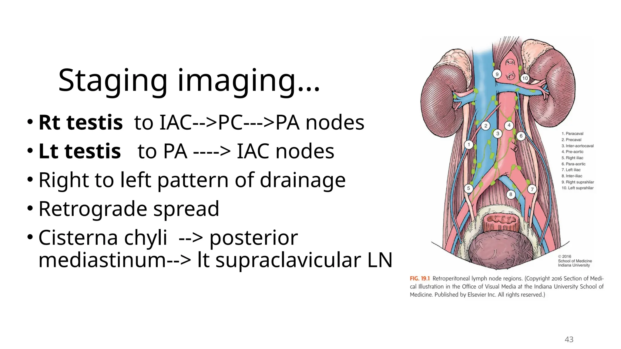 Staging imaging…
• Rt testis to IAC-->PC--->PA nodes
• Lt testis to PA ----> IAC nodes
• Right to left pattern of drainage
• Retrograde spread
• Cisterna chyli --> posterior
mediastinum--> lt supraclavicular LN
43
 