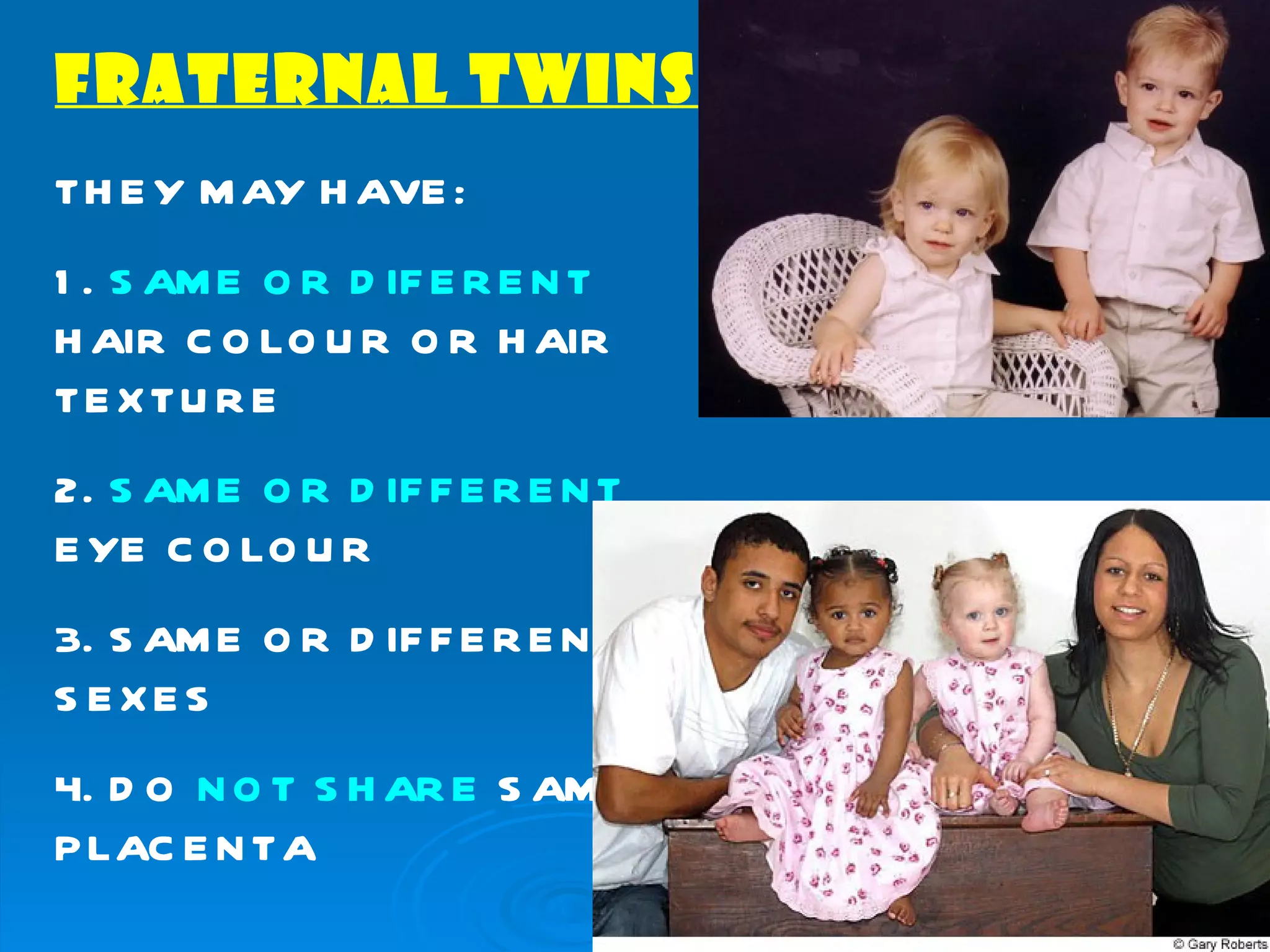 FRATERNAL TWINS
TH E Y M AY H AVE :
1 . S AM E O R D IF E R E N T
H AIR C O LO U R O R H AIR
TE X TU R E
2. S AM E O R D IF F E R E N T
E YE C O LO U R
3. S AM E O R D IF F E R E N T
S EXES
4. D O N O T S H AR E S AM E
P LAC E N TA
 