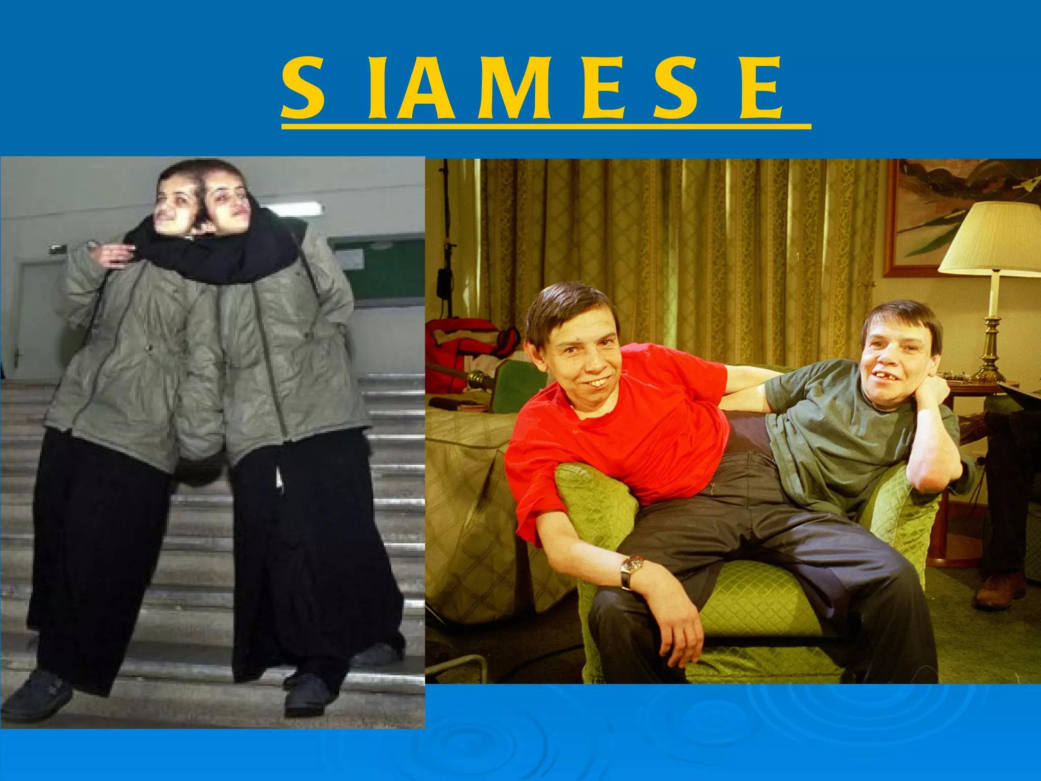 S IA M E S E
  T W IN S
 