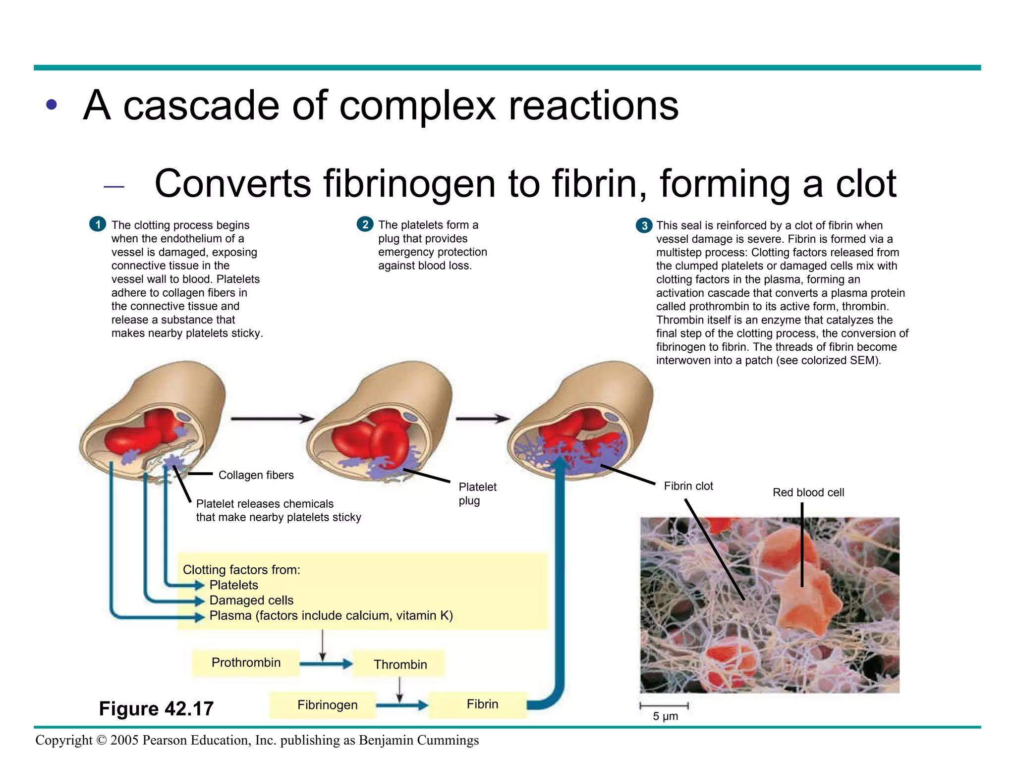 A cascade of complex reactions Converts fibrinogen to fibrin, forming a clot Platelet plug Collagen fibers Platelet releases chemicals that make nearby platelets sticky Clotting factors from: Platelets Damaged cells Plasma (factors include calcium, vitamin K) Prothrombin Thrombin  Fibrinogen Fibrin 5 µm Fibrin clot Red blood cell The clotting process begins  when the endothelium of a  vessel is damaged, exposing  connective tissue in the  vessel wall to blood. Platelets adhere to collagen fibers in  the connective tissue and  release a substance that makes nearby platelets sticky. 1 The platelets form a  plug that provides emergency protection against blood loss. 2 This seal is reinforced by a clot of fibrin when  vessel damage is severe. Fibrin is formed via a multistep process: Clotting factors released from the clumped platelets or damaged cells mix with clotting factors in the plasma, forming an  activation cascade that converts a plasma protein called prothrombin to its active form, thrombin. Thrombin itself is an enzyme that catalyzes the  final step of the clotting process, the conversion of  fibrinogen to fibrin. The threads of fibrin become  interwoven into a patch (see colorized SEM). 3 Figure 42.17 