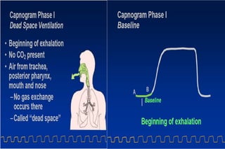 41-capnography.ppt