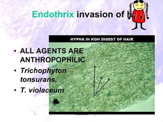41. laboratory diagnosis of common fungal diseases | PPT