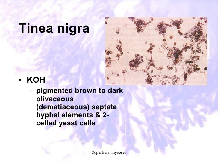41. laboratory diagnosis of common fungal diseases