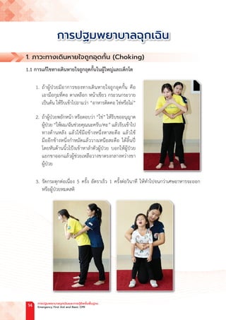 1. ภาวะทางเดินหายใจถูกอุดกั้น (Choking)
1.1 การแก้ไขทางเดินหายใจถูกอุดกั้นในผู้ใหญ่และเด็กโต
1. ถ้าผู้ป่วยมีอาการของทางเดินหายใจถูกอุดกั้น คือ
เอามือกุมที่คอ ตาเหลือก หน้าเขียว กระวนกระวาย
เป็นต้น ให้รีบเข้าไปถามว่า “อาหารติดคอ ใช่หรือไม่”
2. ถ้าผู้ป่วยพยักหน้า หรือตอบว่า “ใช่” ให้รีบขออนุญาต
ผู้ป่วย “ให้ผม/ฉันช่วยคุณนะครับ/คะ” แล้วรีบเข้าไป
ทางด้านหลัง แล้วใช้มือข้างหนึ่งหาสะดือ แล้วใช้
มืออีกข้างหนึ่งก�ำหมัดแล้ววางเหนือสะดือ ใต้ลิ้นปี่
โดยหันด้านนิ้วโป้งเข้าหาล�ำตัวผู้ป่วย บอกให้ผู้ป่วย
แยกขาออกแล้วผู้ช่วยเหลือวางขาตรงกลางหว่างขา
ผู้ป่วย
3. รัดกระตุกต่อเนื่อง 5 ครั้ง อัตราเร็ว 1 ครั้งต่อวินาที ให้ท�ำไปจนกว่าเศษอาหารจะออก
หรือผู้ป่วยหมดสติ
การปฐมพยาบาลฉุกเฉิน
การปฐมพยาบาลฉุกเฉินและการกู้ชีพขั้นพื้นฐาน
Emergency First Aid and Basic CPR
14
 