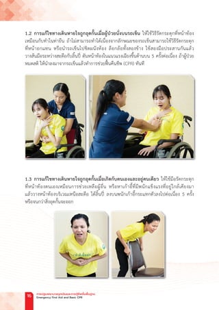 1.2 การแก้ไขทางเดินหายใจถูกอุดกั้นเมื่อผู้ป่วยนั่งบนรถเข็น ให้ใช้วิธีรัดกระตุกที่หน้าท้อง
เหมือนกับท�ำในท่ายืน ถ้าไม่สามารถท�ำได้เนื่องจากลักษณะของรถเข็นสามารถใช้วิธีรัดกระตุก
ที่หน้าอกแทน หรือน�ำรถเข็นไปชิดผนังห้อง ล็อกล้อทั้งสองข้าง ใช้สองมือประสานกันแล้ว
วางส้นมือระหว่างสะดือกับลิ้นปี่ ดันหน้าท้องในแนวแรงเฉียงขึ้นด้านบน 5 ครั้งต่อเนื่อง ถ้าผู้ป่วย
หมดสติ ให้น�ำลงมาจากรถเข็นแล้วท�ำการช่วยฟื้นคืนชีพ (CPR) ทันที
1.3 การแก้ไขทางเดินหายใจถูกอุดกั้นเมื่อเกิดกับตนเองและอยู่คนเดียว ให้ใช้มือรัดกระตุก
ที่หน้าท้องตนเองเหมือนการช่วยเหลือผู้อื่น หรือหาเก้าอี้ที่มีพนักแข็งแรงที่อยู่ใกล้เคียงมา
แล้ววางหน้าท้องบริเวณเหนือสะดือ ใต้ลิ้นปี่ ลงบนพนักเก้าอี้กระแทกตัวลงไปต่อเนื่อง 5 ครั้ง
หรือจนกว่าสิ่งอุดกั้นจะออก
การปฐมพยาบาลฉุกเฉินและการกู้ชีพขั้นพื้นฐาน
Emergency First Aid and Basic CPR
16
 