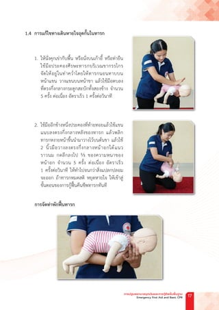 1.4 การแก้ไขทางเดินหายใจอุดกั้นในทารก
1. ให้นั่งคุกเข่ากับพื้น หรือนั่งบนเก้าอี้ หรือท่ายืน
ใช้มือประคองศีรษะทารกบริเวณขากรรไกร
จัดให้อยู่ในท่าคว�่ำโดยให้ทารกนอนทาบบน
หน้าแขน วางแขนบนหน้าขา แล้วใช้มือตบลง
ที่ตรงกึ่งกลางกระดูกสะบักทั้งสองข้าง จ�ำนวน
5 ครั้ง ต่อเนื่อง อัตราเร็ว 1 ครั้งต่อวินาที
2. ใช้มืออีกข้างหนึ่งประคองที่ท้ายทอยแล้วใช้แขน
แนบลงตรงกึ่งกลางหลังของทารก แล้วพลิก
ทารกหงายหน้าขึ้นน�ำมาวางไว้บนต้นขา แล้วใช้
2 นิ้วมือวางลงตรงกึ่งกลางหน้าอกใต้แนว
ราวนม กดลึกลงไป ⅓ ของความหนาของ
หน้าอก จ�ำนวน 5 ครั้ง ต่อเนื่อง อัตราเร็ว
1 ครั้งต่อวินาที ให้ท�ำไปจนกว่าสิ่งแปลกปลอม
จะออก ถ้าทารกหมดสติ หยุดหายใจ ให้เข้าสู่
ขั้นตอนของการกู้ฟื้นคืนชีพทารกทันที
การจัดท่าพักฟื้นทารก
การปฐมพยาบาลฉุกเฉินและการกู้ชีพขั้นพื้นฐาน
Emergency First Aid and Basic CPR 17
 