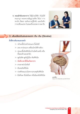 4. คอยเฝ้าสังเกตอาการ ให้ผู้ป่วยได้พัก กันไม่ให้
คนมามุง คอยตรวจสัญญาณชีพ ได้แก่ การ
หายใจ ชีพจร ระดับความรู้สึกตัว และบันทึก
การเปลี่ยนแปลง ในขณะที่รอรถพยาบาลมารับ
3. เส้นเลือดในสมองแตก ตีบ ตัน (Stroke)
สิ่งที่ควรสังเกตและจดจ�ำ
➣ กล้ามเนื้อใบหน้าอ่อนแรง ยิ้มไม่ได้
➣ แขน ขาอ่อนแรง เคลื่อนไหวได้ข้างเดียว
➣ อ่อนเปลี้ยทันทีทันใด ด้านใดด้านหนึ่ง หรือ
ทั้งสองด้านของล�ำตัว
➣ พูดไม่ชัด พูดไม่รู้เรื่อง ทันทีทันใด
➣ บันทึกเวลาที่เริ่มเกิดอาการ
➣ สายตาพร่ามัวทันที
➣ สับสนทันทีทันใด
➣ ปวดศีรษะแบบไม่ทราบสาเหตุทันทีทันใด
➣ มึนศีรษะ ยืนไม่มั่นคง หรือล้มลงทันทีทันใด
แหล่งที่มา
https://en.wikipedia.org/wiki/Stroke
การปฐมพยาบาลฉุกเฉินและการกู้ชีพขั้นพื้นฐาน
Emergency First Aid and Basic CPR 19
 