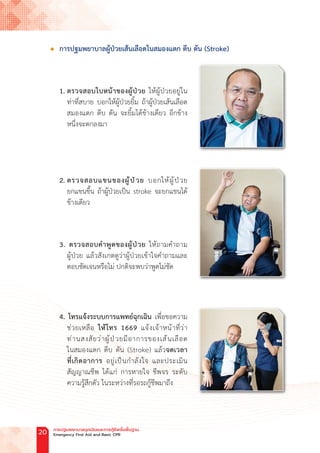 l การปฐมพยาบาลผู้ป่วยเส้นเลือดในสมองแตก ตีบ ตัน (Stroke)
1. ตรวจสอบใบหน้าของผู้ป่วย ให้ผู้ป่วยอยู่ใน
ท่าที่สบาย บอกให้ผู้ป่วยยิ้ม ถ้าผู้ป่วยเส้นเลือด
สมองแตก ตีบ ตัน จะยิ้มได้ข้างเดียว อีกข้าง
หนึ่งจะตกลงมา
		
2. ตรวจสอบแขนของผู้ป่วย บอกให้ผู้ป่วย
ยกแขนขึ้น ถ้าผู้ป่วยเป็น stroke จะยกแขนได้
ข้างเดียว
3. ตรวจสอบค�ำพูดของผู้ป่วย ให้ถามค�ำถาม
ผู้ป่วย แล้วสังเกตดูว่าผู้ป่วยเข้าใจค�ำถามและ
ตอบชัดเจนหรือไม่ ปกติจะพบว่าพูดไม่ชัด
		
4. โทรแจ้งระบบการแพทย์ฉุกเฉิน เพื่อขอความ
ช่วยเหลือ ให้โทร 1669 แจ้งเจ้าหน้าที่ว่า
ท่านสงสัยว่าผู้ป่วยมีอาการของเส้นเลือด
ในสมองแตก ตีบ ตัน (Stroke) แล้วจดเวลา
ที่เกิดอาการ อยู่เป็นก�ำลังใจ และประเมิน
สัญญาณชีพ ได้แก่ การหายใจ ชีพจร ระดับ
ความรู้สึกตัว ในระหว่างที่รอรถกู้ชีพมาถึง
การปฐมพยาบาลฉุกเฉินและการกู้ชีพขั้นพื้นฐาน
Emergency First Aid and Basic CPR
20
 