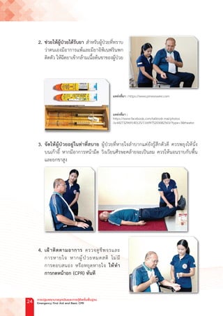 2. ช่วยให้ผู้ป่วยได้รับยา ส�ำหรับผู้ป่วยที่ทราบ
ว่าตนเองมีอาการแพ้และมียาอิพิเนฟรินพก
ติดตัว ให้ฉีดยาเข้ากล้ามเนื้อต้นขาของผู้ป่วย
		 3. จัดให้ผู้ป่วยอยู่ในท่าที่สบาย ผู้ป่วยที่หายใจล�ำบากแต่ยังรู้สึกตัวดี ควรพยุงให้นั่ง
บนเก้าอี้ หากมีอาการหน้ามืด วิงเวียนศีรษะคล้ายจะเป็นลม ควรให้นอนราบกับพื้น
และยกขาสูง
		 4. เฝ้าติดตามอาการ ตรวจดูชีพจรและ
การหายใจ หากผู้ป่วยหมดสติ ไม่มี
การตอบสนอง หรือหยุดหายใจ ให้ท�ำ
การกดหน้าอก (CPR) ทันที
แหล่งที่มา : https://www.prnewswire.com
แหล่งที่มา :
https://www.facebook.com/talktodr.mai/photos
/a.642732969140125/1169975203082563/?type=3&theater
การปฐมพยาบาลฉุกเฉินและการกู้ชีพขั้นพื้นฐาน
Emergency First Aid and Basic CPR
24
 