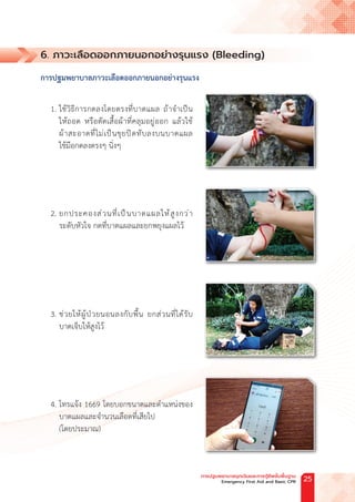 6. ภาวะเลือดออกภายนอกอย่างรุนแรง (Bleeding)
การปฐมพยาบาลภาวะเลือดออกภายนอกอย่างรุนแรง
1. ใช้วิธีการกดลงโดยตรงที่บาดแผล ถ้าจ�ำเป็น
ให้ถอด หรือตัดเสื้อผ้าที่คลุมอยู่ออก แล้วใช้
ผ้าสะอาดที่ไม่เป็นขุยปิดทับลงบนบาดแผล
ใช้มือกดลงตรงๆ นิ่งๆ
2. ยกประคองส่วนที่เป็นบาดแผลให้สูงกว่า
ระดับหัวใจ กดที่บาดแผลและยกพยุงแผลไว้
3. ช่วยให้ผู้ป่วยนอนลงกับพื้น ยกส่วนที่ได้รับ
บาดเจ็บให้สูงไว้
4. โทรแจ้ง 1669 โดยบอกขนาดและต�ำแหน่งของ
บาดแผลและจ�ำนวนเลือดที่เสียไป
(โดยประมาณ)
การปฐมพยาบาลฉุกเฉินและการกู้ชีพขั้นพื้นฐาน
Emergency First Aid and Basic CPR 25
 