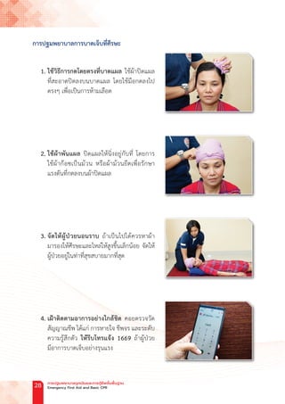 การปฐมพยาบาลการบาดเจ็บที่ศีรษะ
1. ใช้วิธีการกดโดยตรงที่บาดแผล ใช้ผ้าปิดแผล
ที่สะอาดปิดลงบนบาดแผล โดยใช้มือกดลงไป
ตรงๆ เพื่อเป็นการห้ามเลือด
2. ใช้ผ้าพันแผล ปิดแผลให้นิ่งอยู่กับที่ โดยการ
ใช้ผ้าก๊อซเป็นม้วน หรือผ้าม้วนยืดเพื่อรักษา
แรงดันที่กดลงบนผ้าปิดแผล
3. จัดให้ผู้ป่วยนอนราบ ถ้าเป็นไปได้ควรหาผ้า
มารองให้ศีรษะและไหล่ให้สูงขึ้นเล็กน้อย จัดให้
ผู้ป่วยอยู่ในท่าที่สุขสบายมากที่สุด
4. เฝ้าติดตามอาการอย่างใกล้ชิด คอยตรวจวัด
สัญญาณชีพ ได้แก่ การหายใจ ชีพจร และระดับ
ความรู้สึกตัว ให้รีบโทรแจ้ง 1669 ถ้าผู้ป่วย
มีอาการบาดเจ็บอย่างรุนแรง
การปฐมพยาบาลฉุกเฉินและการกู้ชีพขั้นพื้นฐาน
Emergency First Aid and Basic CPR
28
 