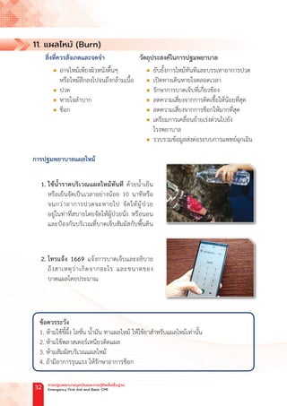 11. แผลไหม้ (Burn)
สิ่งที่ควรสังเกตและจดจ�ำ วัตถุประสงค์ในการปฐมพยาบาล
		
l อาจไหม้เพียงผิวหนังตื้นๆ l ยับยั้งการไหม้ทันทีและบรรเทาอาการปวด
หรือไหม้ลึกลงไปจนถึงกล้ามเนื้อ l เปิดทางเดินหายใจตลอดเวลา
		
l ปวด l รักษาการบาดเจ็บที่เกี่ยวข้อง
		
l หายใจล�ำบาก l ลดความเสี่ยงจากการติดเชื้อให้น้อยที่สุด
		
l ช็อก l ลดความเสี่ยงจากการช็อกให้มากที่สุด
					l เตรียมการเคลื่อนย้ายเร่งด่วนไปยัง
โรงพยาบาล
					l รวบรวมข้อมูลส่งต่อระบบการแพทย์ฉุกเฉิน
การปฐมพยาบาลแผลไหม้
1. ใช้น�้ำราดบริเวณแผลไหม้ทันที ด้วยน�้ำเย็น
หรือเย็นจัดเป็นเวลาอย่างน้อย 10 นาทีหรือ
จนกว่าอาการปวดจะหายไป จัดให้ผู้ป่วย
อยู่ในท่าที่สบายโดยจัดให้ผู้ป่วยนั่ง หรือนอน
และป้องกันบริเวณที่บาดเจ็บสัมผัสกับพื้นดิน
2. โทรแจ้ง 1669 แจ้งการบาดเจ็บและอธิบาย
ถึงสาเหตุว่าเกิดจากอะไร และขนาดของ
บาดแผลโดยประมาณ
ข้อควรระวัง
1. ห้ามใช้ขี้ผึ้ง โลชั่น น�้ำมัน ทาแผลไหม้ ให้ใช้ยาส�ำหรับแผลไหม้เท่านั้น
2. ห้ามใช้พลาสเตอร์เหนียวติดแผล
3. ห้ามสัมผัสบริเวณแผลไหม้
4. ถ้ามีอาการรุนแรง ให้รักษาอาการช็อก
การปฐมพยาบาลฉุกเฉินและการกู้ชีพขั้นพื้นฐาน
Emergency First Aid and Basic CPR
32
 