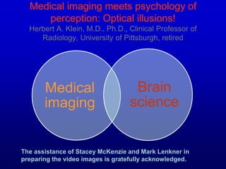 Medical imaging meets psychology of
perception: Optical illusions!
Herbert A. Klein, M.D., Ph.D., Clinical Professor of
Radiology, University of Pittsburgh, retired
Medical
imaging
Brain
science
The assistance of Stacey McKenzie and Mark Lenkner in
preparing the video images is gratefully acknowledged.
 