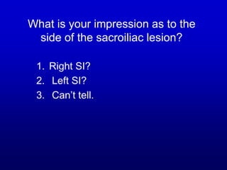 What is your impression as to the
side of the sacroiliac lesion?
1. Right SI?
2. Left SI?
3. Can’t tell.
 
