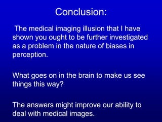Conclusion:
The medical imaging illusion that I have
shown you ought to be further investigated
as a problem in the nature of biases in
perception.
What goes on in the brain to make us see
things this way?
The answers might improve our ability to
deal with medical images.
 