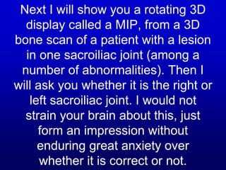 Next I will show you a rotating 3D
display called a MIP, from a 3D
bone scan of a patient with a lesion
in one sacroiliac joint (among a
number of abnormalities). Then I
will ask you whether it is the right or
left sacroiliac joint. I would not
strain your brain about this, just
form an impression without
enduring great anxiety over
whether it is correct or not.
 