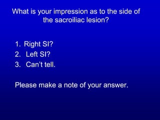 What is your impression as to the side of
the sacroiliac lesion?
1. Right SI?
2. Left SI?
3. Can’t tell.
Please make a note of your answer.
 