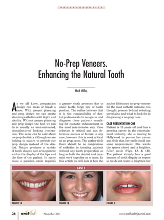 26 oralhealth November 2011 www.oralhealthjournal.com
P R O S T H O D O N T I C S
No-Prep Veneers.
Enhancing the Natural Tooth
Mark Willes,
A
s we all know, preparation
design can make or break a
case. With proper planning
and prep design we can create
stunning esthetics with depth and
vitality. Without proper planning
and prep design the best we can
do is usually an over-contoured,
manufactured looking restora-
tion. The same can be said about
no-prep dentistry although we are
looking to nature to provide our
prep design instead of the den-
tist. Nature produces a variety
of tooth shapes and arrangement
within the display of the lips and
the face of the patient. In many
cases a patient’s smile requires
a greater tooth presence due to
small teeth, large lips or tooth
position. The author believes that
it is the responsibility of den-
tal professionals to recognize and
diagnose these patients search-
ing for cosmetic enhancement in
the most non-invasive way. Case
selection is critical and can de-
termine success or failure in any
case, however this is most critical
on no prep cases. The author feels
there should be no compromise
of esthetics in treating patients
without any tooth preparation as
long as both the dentist and cera-
mist work together as a team. In
this article we will look at how the
author fabricates no-prep veneers
for the most esthetic outcome, the
thought process behind selecting
porcelains and what to look for in
diagnosing a no-prep case.
CASE PRESENTATION ONE
Patient is 15 years old and has a
growing career in the entertain-
ment industry, she is moving to
Hollywood to pursue her career
and feels that her smile could use
some improvement. She wants
the spaces closed and a brighter,
fuller smile (Figs. 1A & 1B),
The patient already has a good
amount of tooth display in repose
so we do not want to lengthen her
CASE 1
FIGURE 1A FIGURE 1B FIGURE 2
 