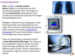 Animated Science
2016
Complex Equipment...
CCDs...A CCD is a charge-coupled
device. Modern X-ray machines use CCDs
instead of photographic film. The images are
formed electronically, allowing them to be
recorded and stored more easily than the images
from photographic film.
CT scans...Traditional X-ray imaging gives a two-
dimensional (2D) view of the body from one
angle. This can result in detail being obscured by
other structures in the body. Computerised
tomography (CT) scans involve taking a range of
X-ray images from various positions.
These are processed by a computer to build
a three-dimensional (3D) image. This image can
be manipulated in order to see the structures
within the body at different layers and from
different points of view. This lets a doctor gain a
much greater insight into what is wrong with a
patient.
 