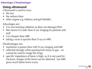 Animated Science
2016
Advantages / Disadvantages
 