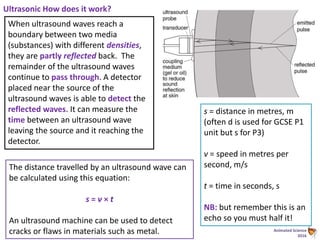 Animated Science
2016
Ultrasonic How does it work?
When ultrasound waves reach a
boundary between two media
(substances) with different densities,
they are partly reflected back. The
remainder of the ultrasound waves
continue to pass through. A detector
placed near the source of the
ultrasound waves is able to detect the
reflected waves. It can measure the
time between an ultrasound wave
leaving the source and it reaching the
detector.
The distance travelled by an ultrasound wave can
be calculated using this equation:
s = v × t
An ultrasound machine can be used to detect
cracks or flaws in materials such as metal.
s = distance in metres, m
(often d is used for GCSE P1
unit but s for P3)
v = speed in metres per
second, m/s
t = time in seconds, s
NB: but remember this is an
echo so you must half it!
 